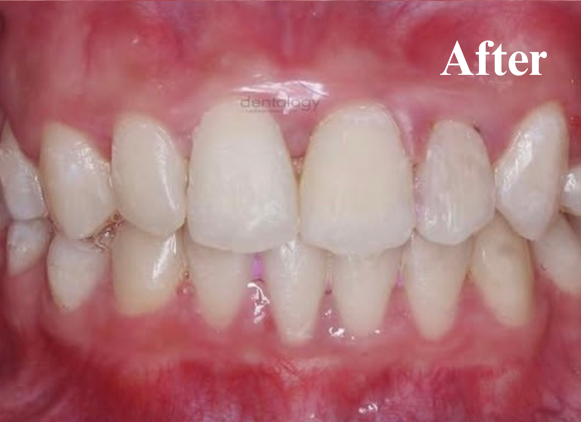 Orthodontic dokter gigi denpasar