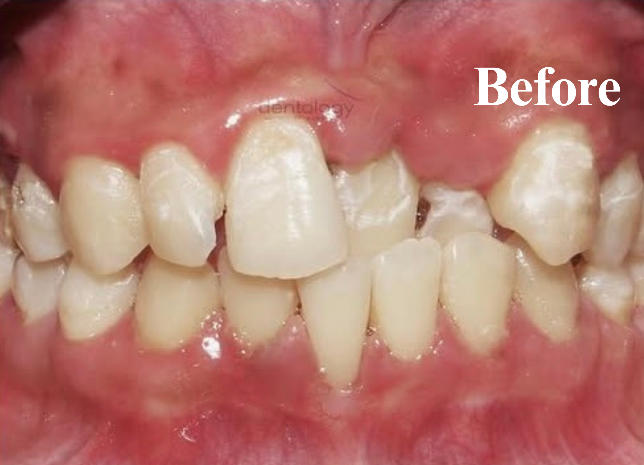 Orthodontic dokter gigi denpasar