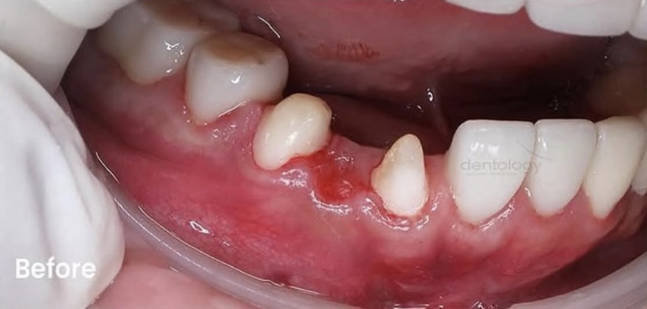 Prosthodontic_before Large