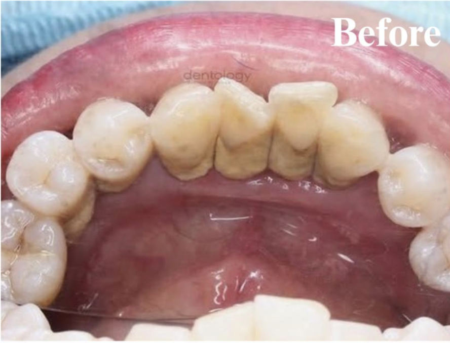 Periodontic dokter gigi denpasar